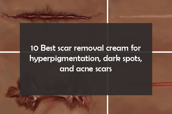 10 Best scar removal cream for hyperpigmentation, dark spots, and acne scars